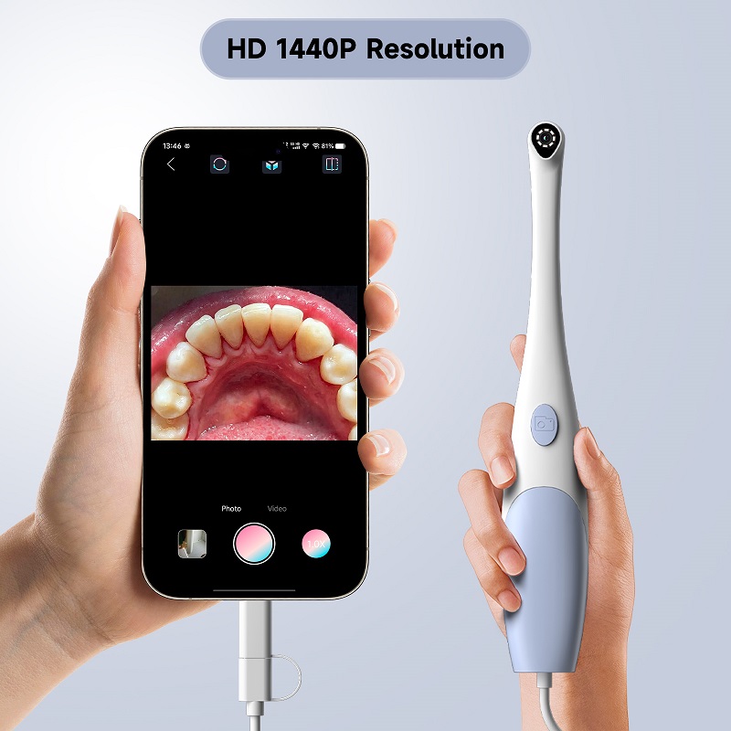 Oral Endoscope Camera 1440P Ph - Photography Lighting Description review and price