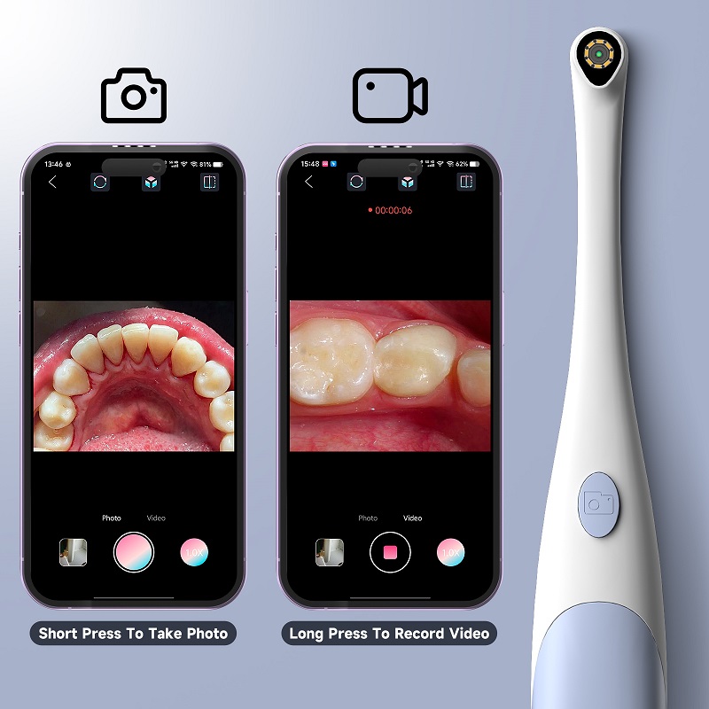 Oral Endoscope Camera 1440P Ph - Photography Lighting Description review and price